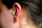 needles in the ear